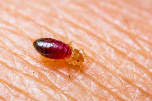close up of bed bug on the skin