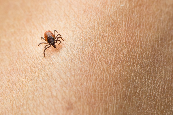 westen black legged tick on skin