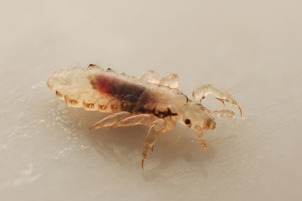 head lice
