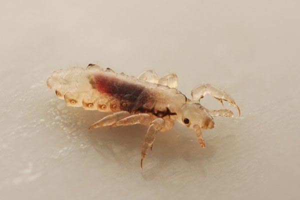head lice
