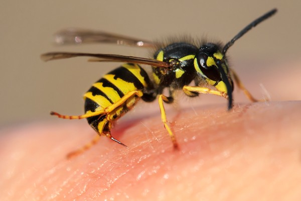 Stinger on skin