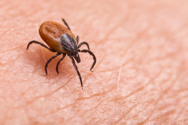 Tick on skin