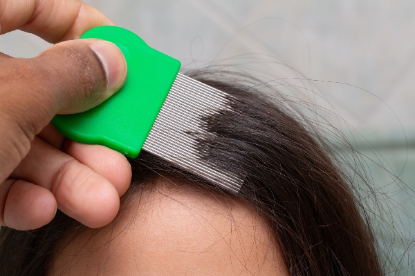 Searching for head lice using comb