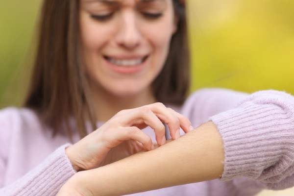 Woman scratching arm