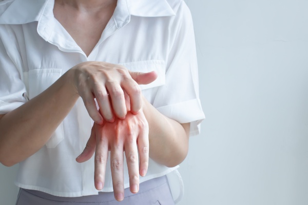 Woman scratching her fingers