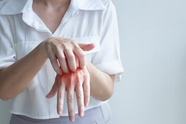 Woman scratching her fingers