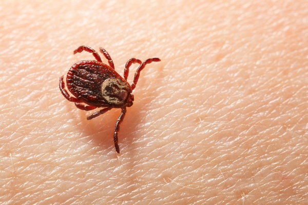 American dog tick on skin